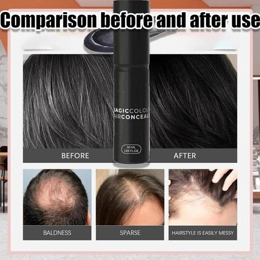 (🔥Kúp 1 získaj 1 zadarmo🔥)Korektor na pokožku hlavy pre hustejšie a prirodzenejšie vlasy
