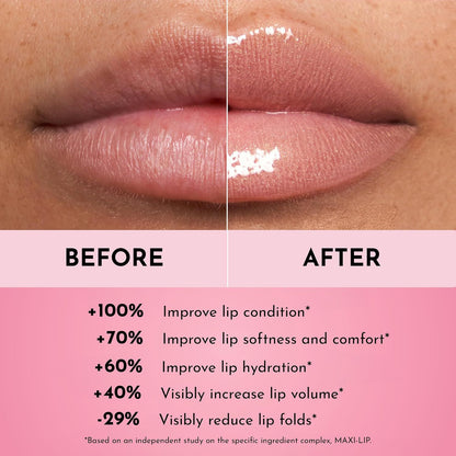 【🔥Kúp 1 získaj 1 zadarmo🔥】Zabudnite na vypĺňajúci lesk na pery Filler Lip Plumping Line Smoothing Gloss