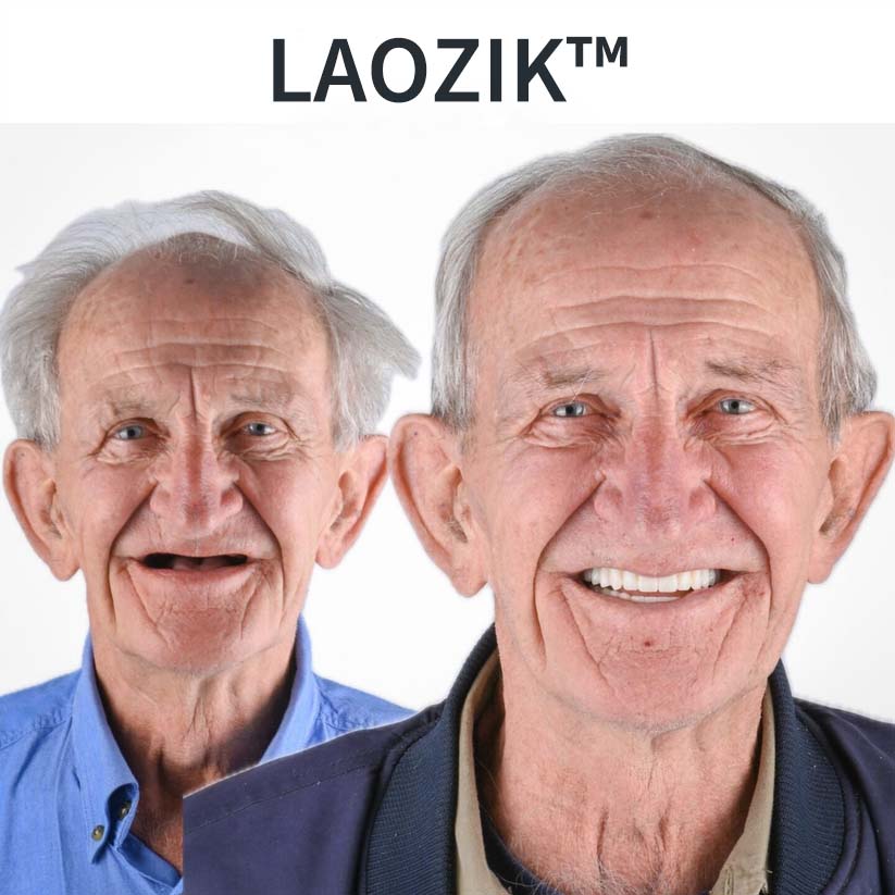 🔥【Gél na zuby zadarmo】Funkčné zubné protézy AdaptableFit