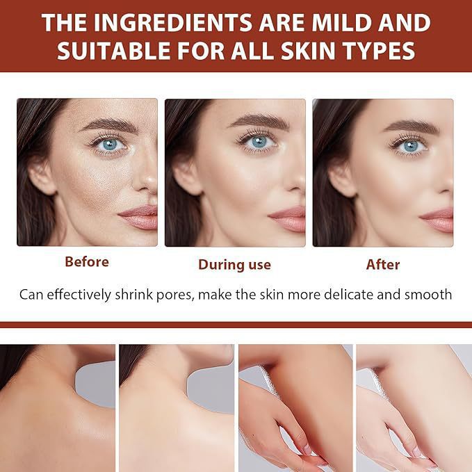 🔥Kúp 1 získaj 1 zadarmo🔥Exfoliačný gél s čistiacimi enzýmami